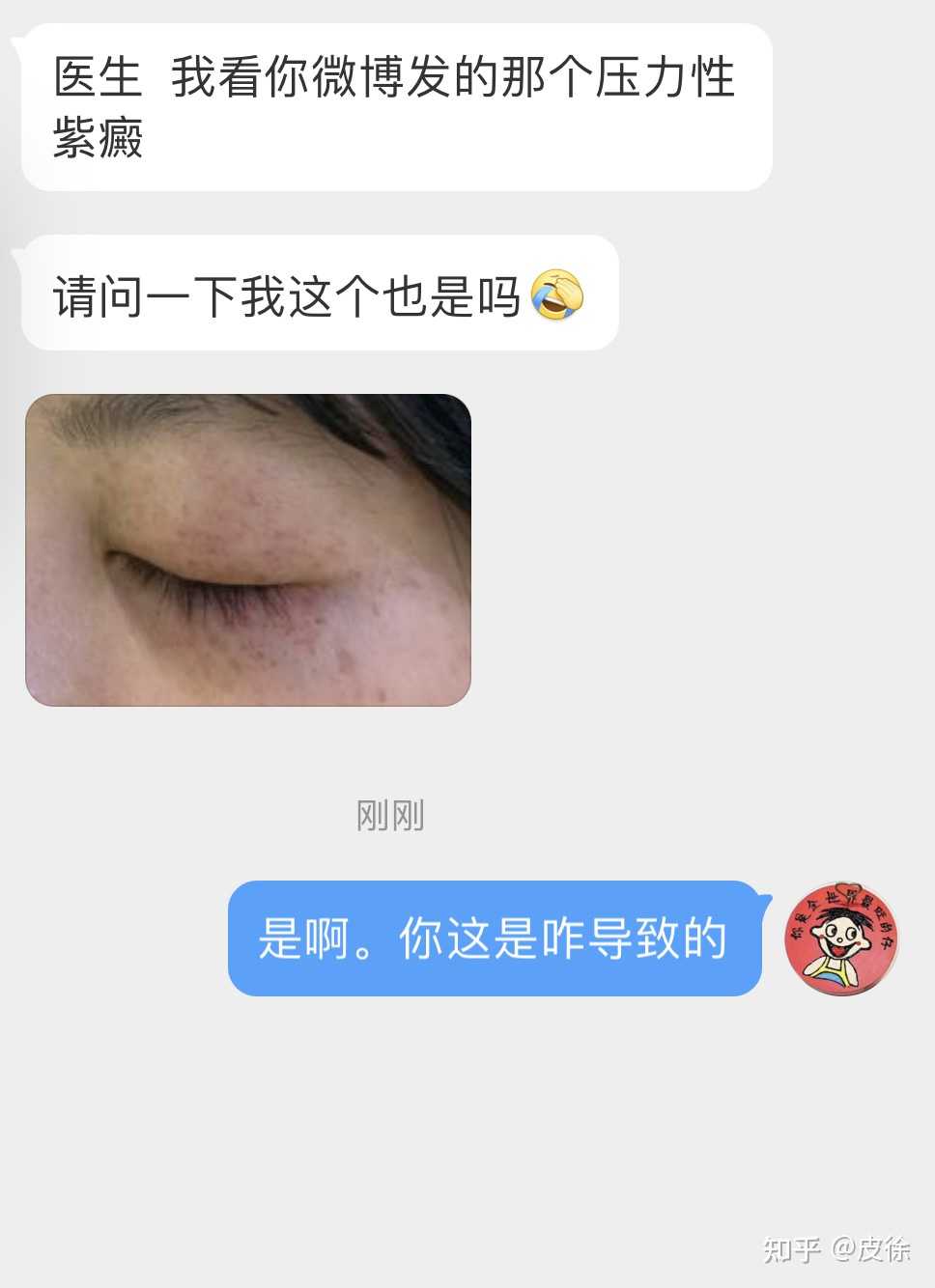 的之前他看过我相关的科普自己诊断为压力性紫癜问我是不是需要担心吗