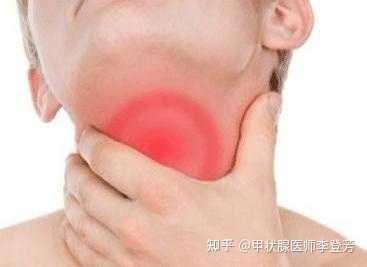 桥本氏甲状腺炎早期最常见的症状
