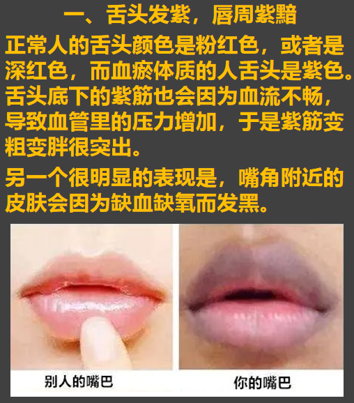 雷师兄健康