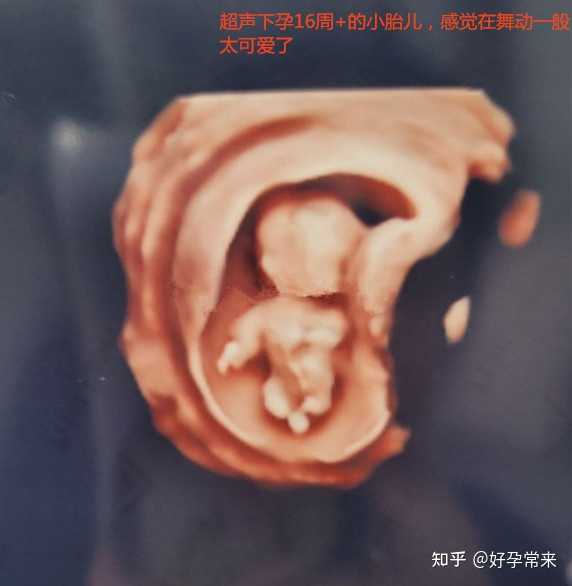 孕16周3天超声下的小胎儿感觉在舞动一般太可爱了准妈妈看着屏幕上的