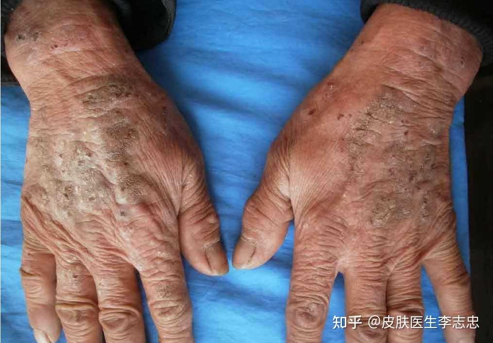 皮肤医生李志忠