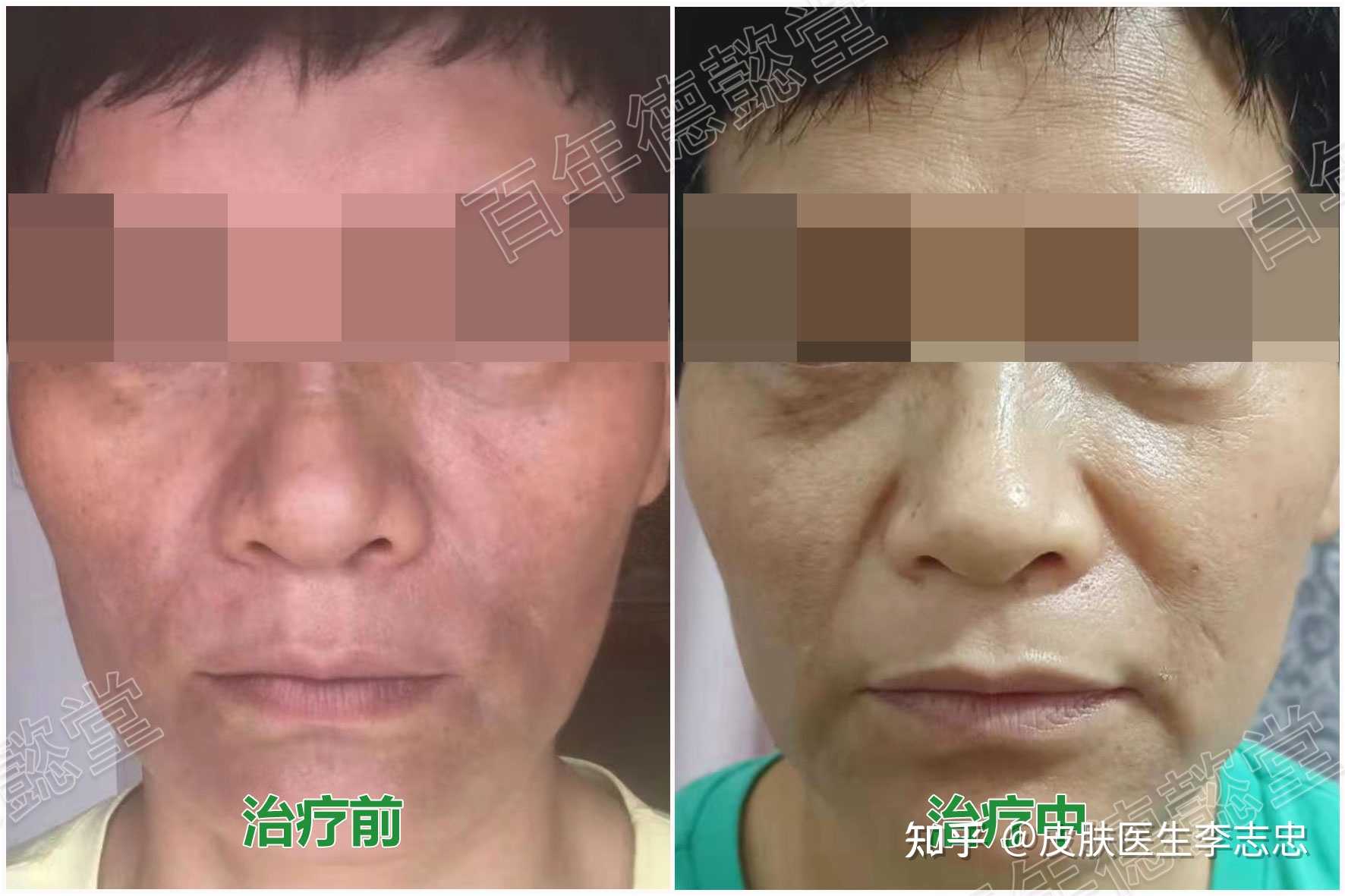 皮肤医生李志忠