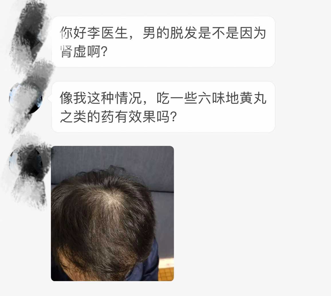 毛发医生李丙双 的想法 肾虚脱发其实属于中医理论的范畴,在现代