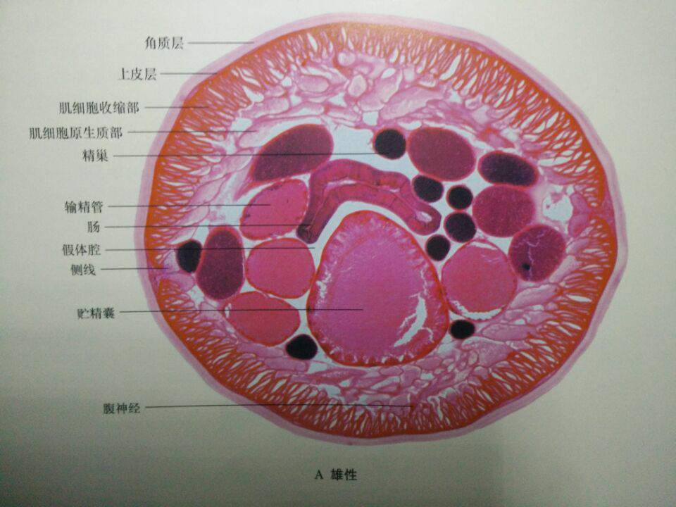 这两张环毛蚓的横切面图中分别可以看出什么结构