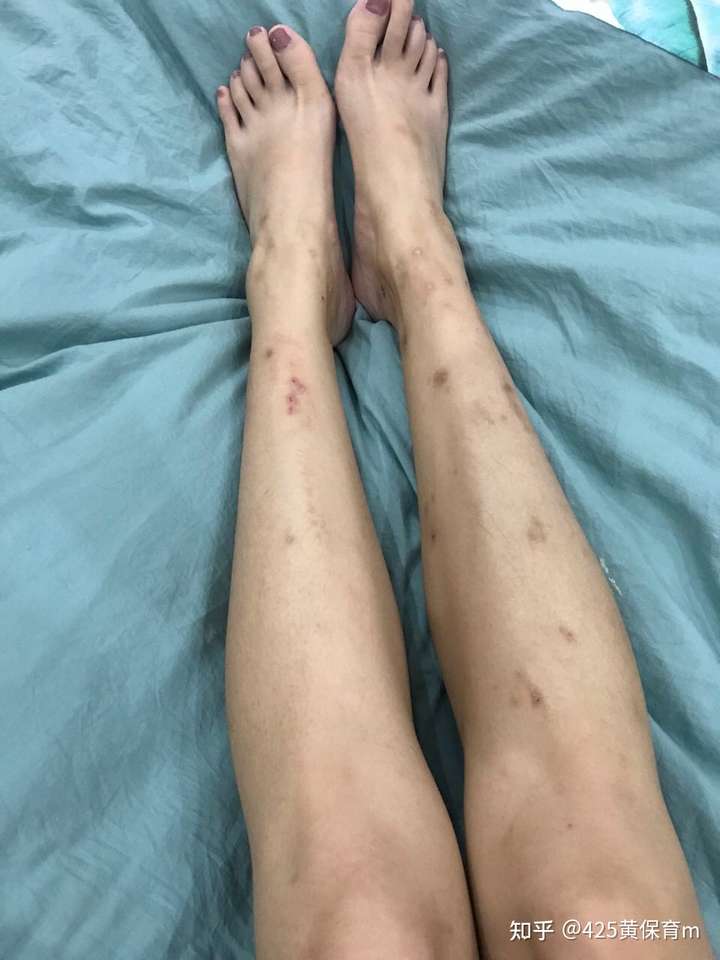或者有什么祛疤遮疤的产品介绍?
