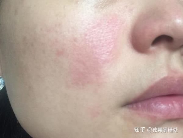 男士如何护肤保养_保养护肤水果_男士如何护肤保养