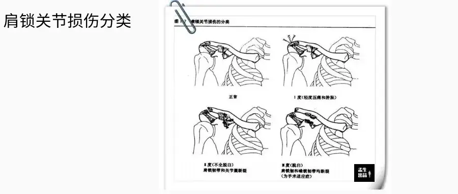 肩关节肌骨解剖学肩关节基石肩锁关节基础与损伤