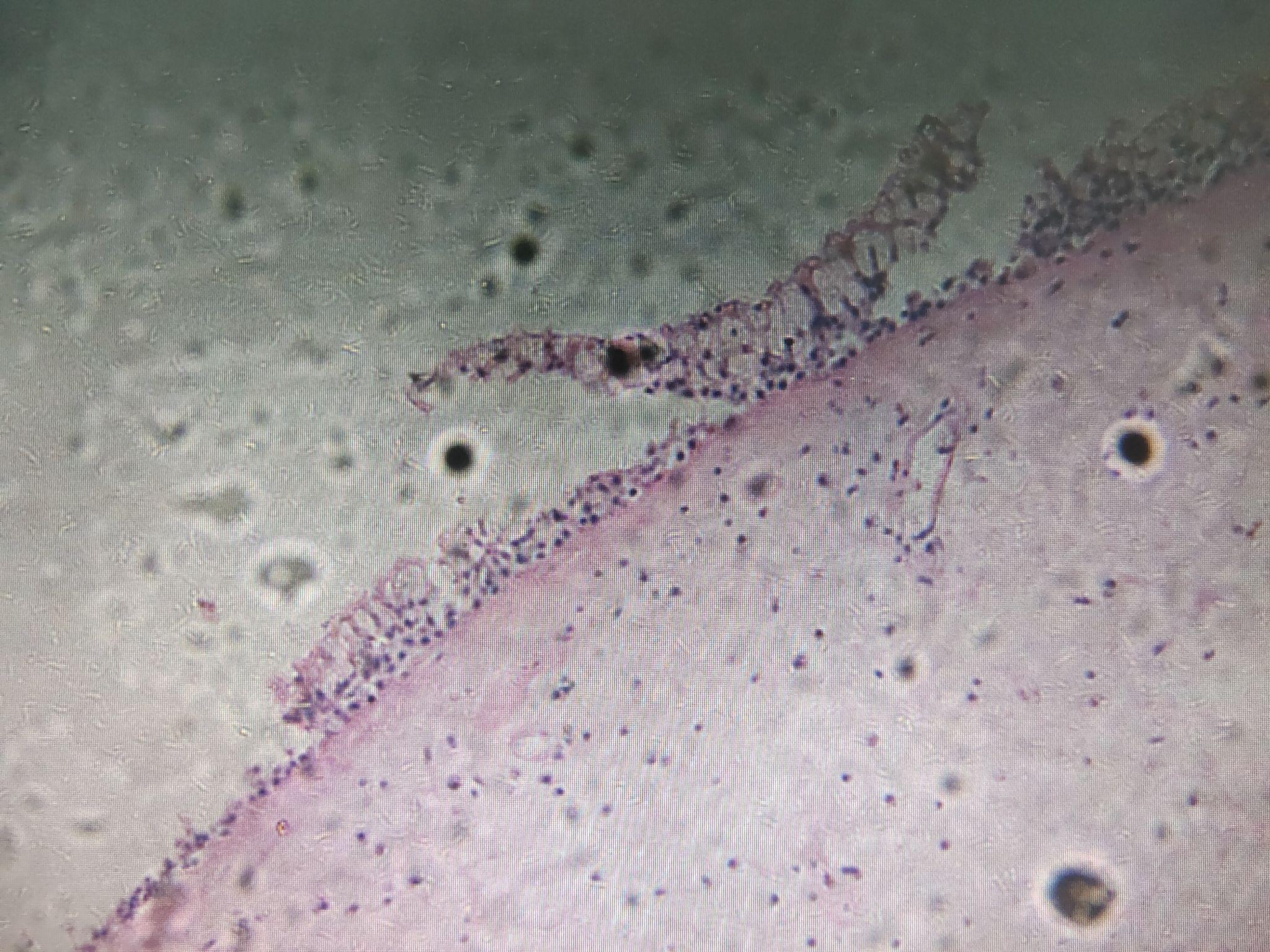 鼻息肉的病理切片红蓝铅笔绘图有吗