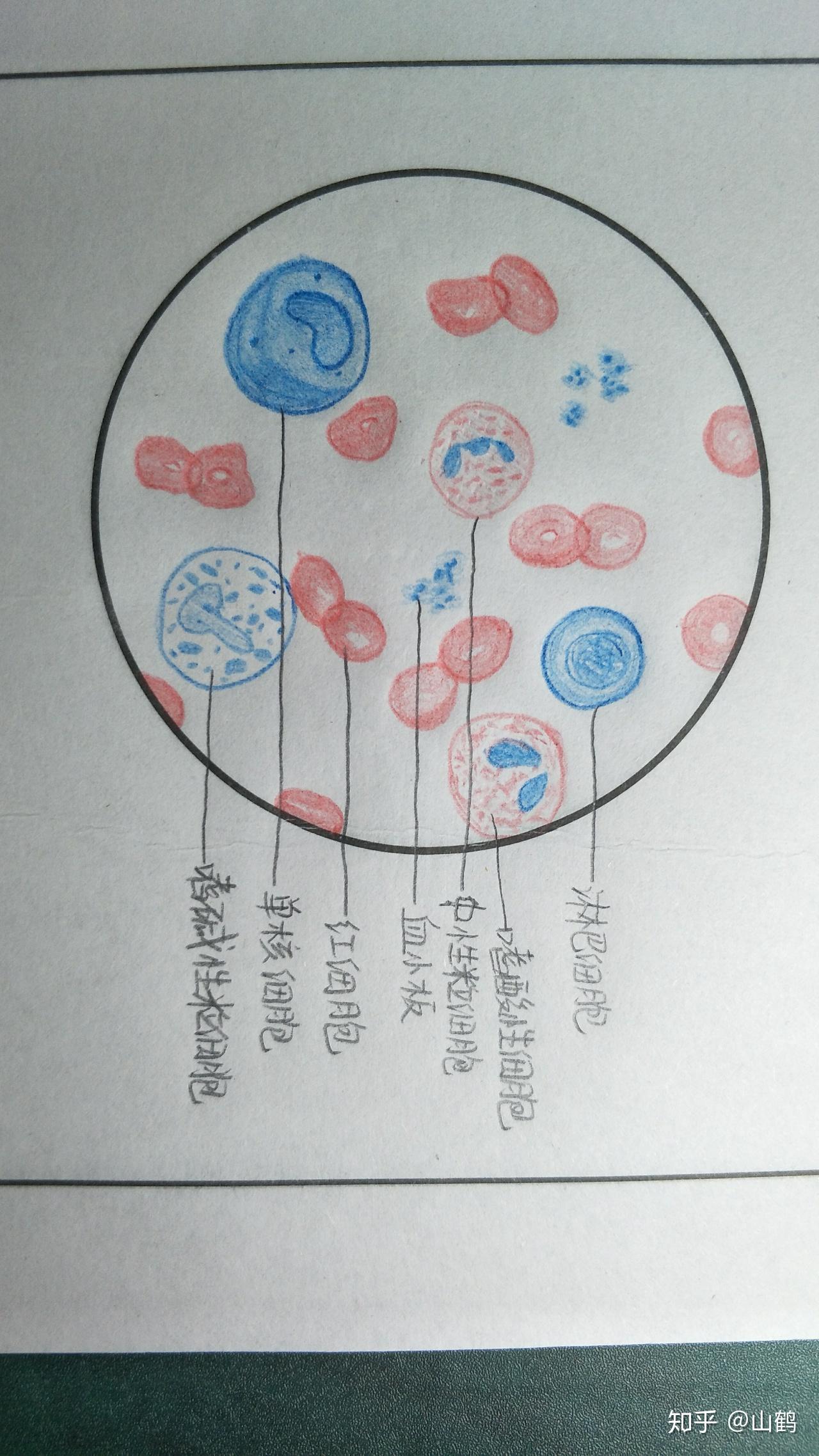 有没有红蓝铅笔血涂片的手绘图