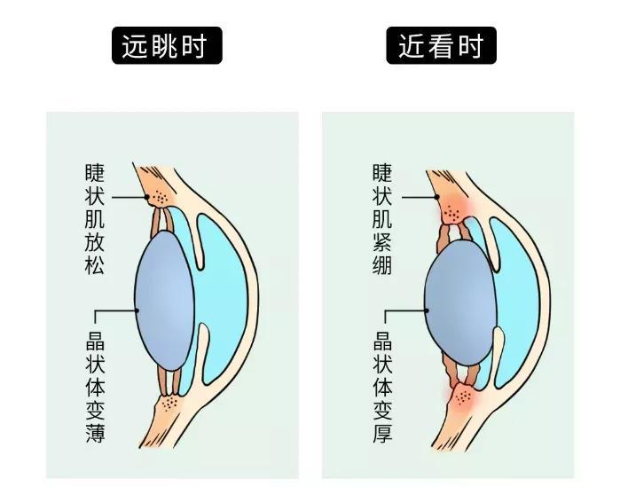 睫状肌是什么有什么作用