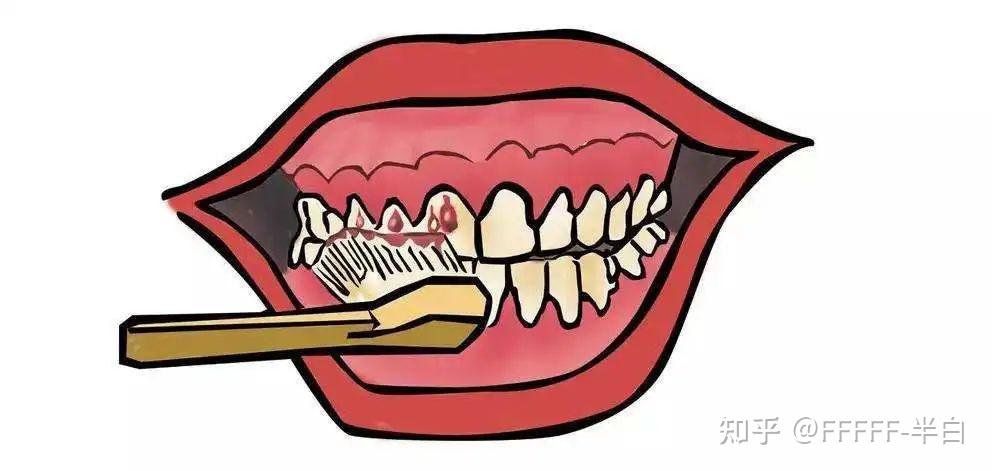 牙龈出血好几个月了会是白血病吗
