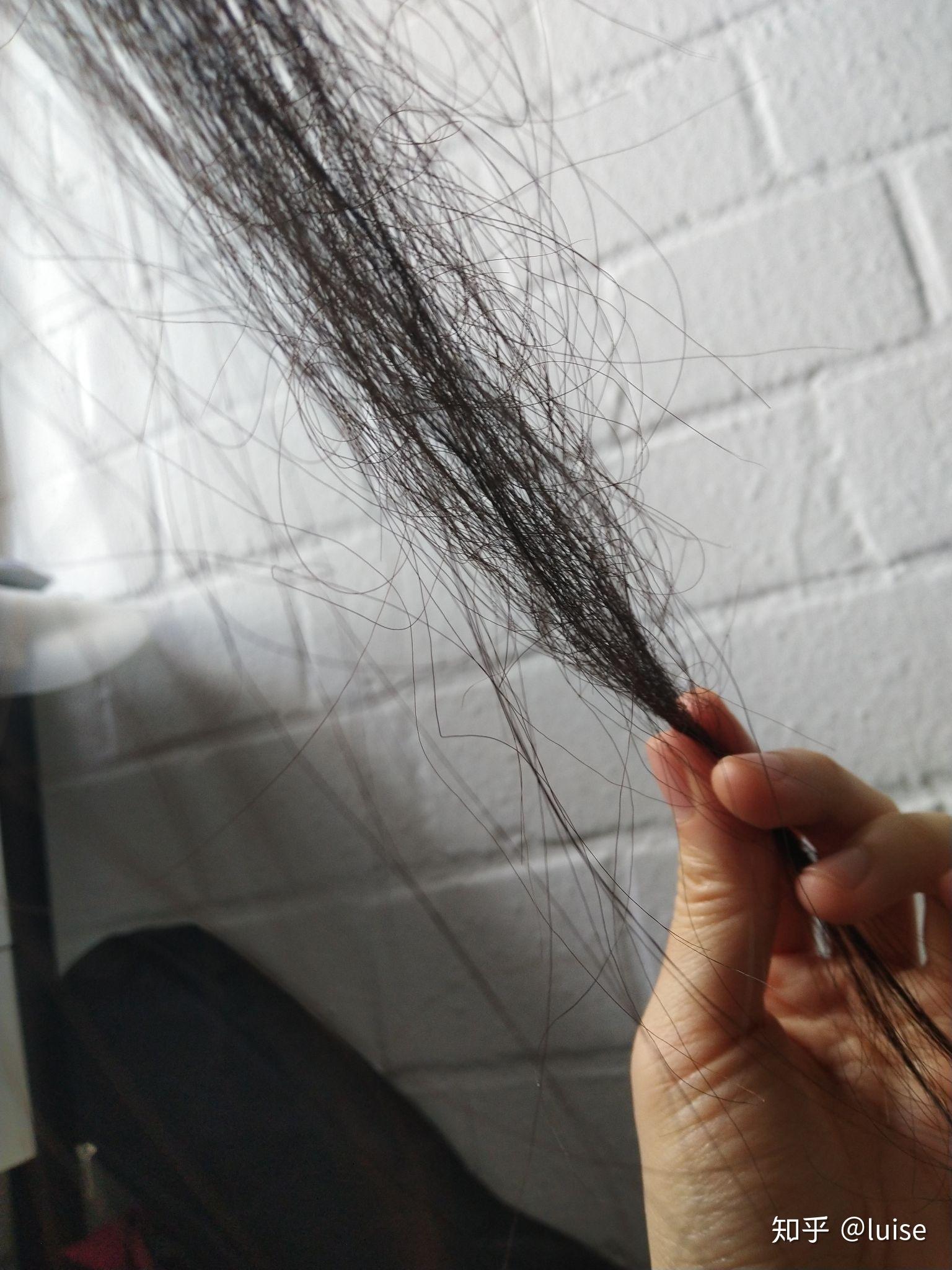 为什么我会有部分头发的发尾像钢丝一样弯曲是什么原因造成的属于沙发