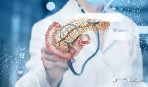 揭开胰腺癌的神秘面纱