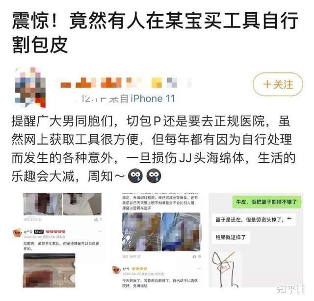 成年后再割包皮是怎样的体验