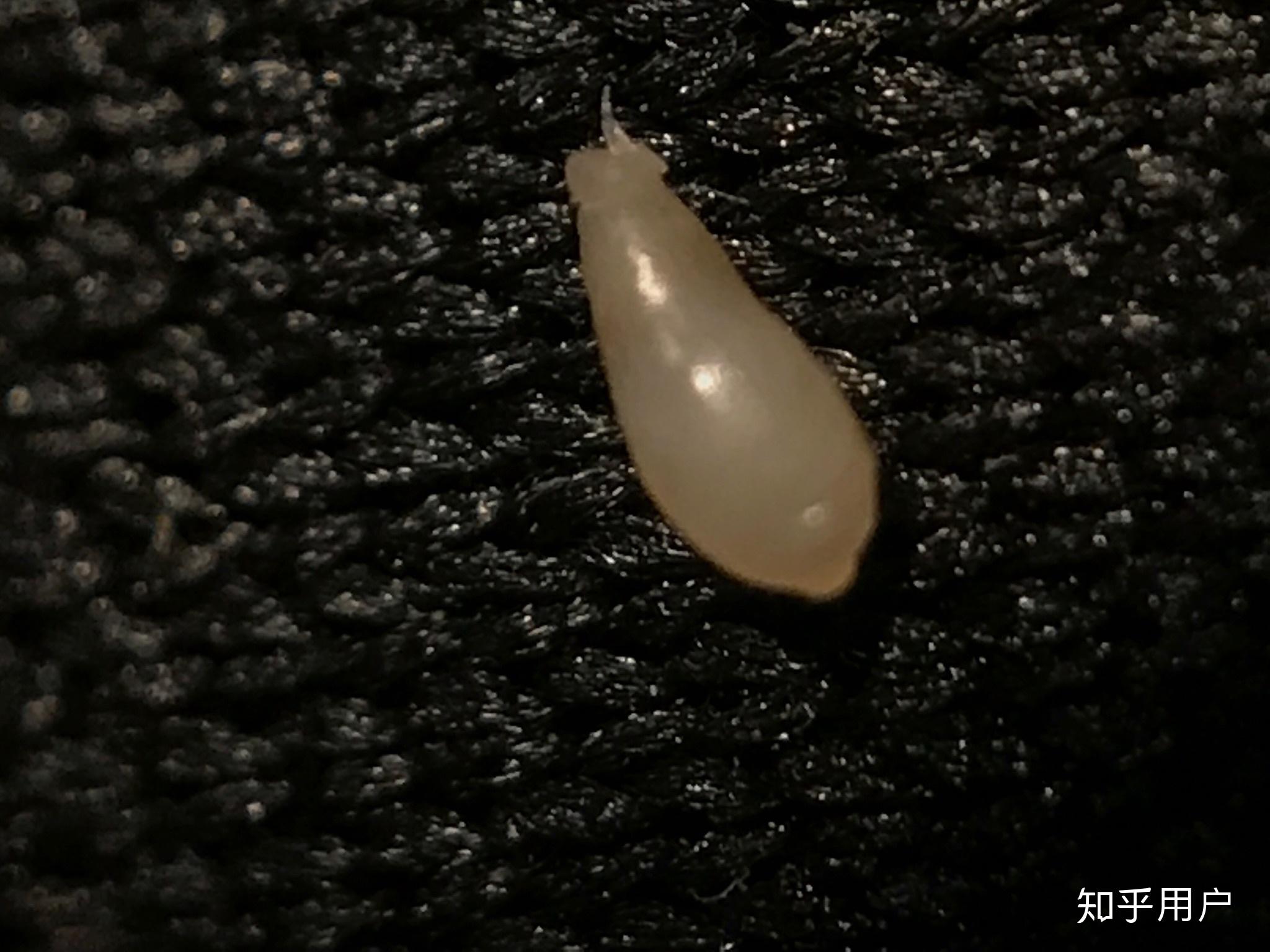 痘痘里面挤出来的小米粒是什么