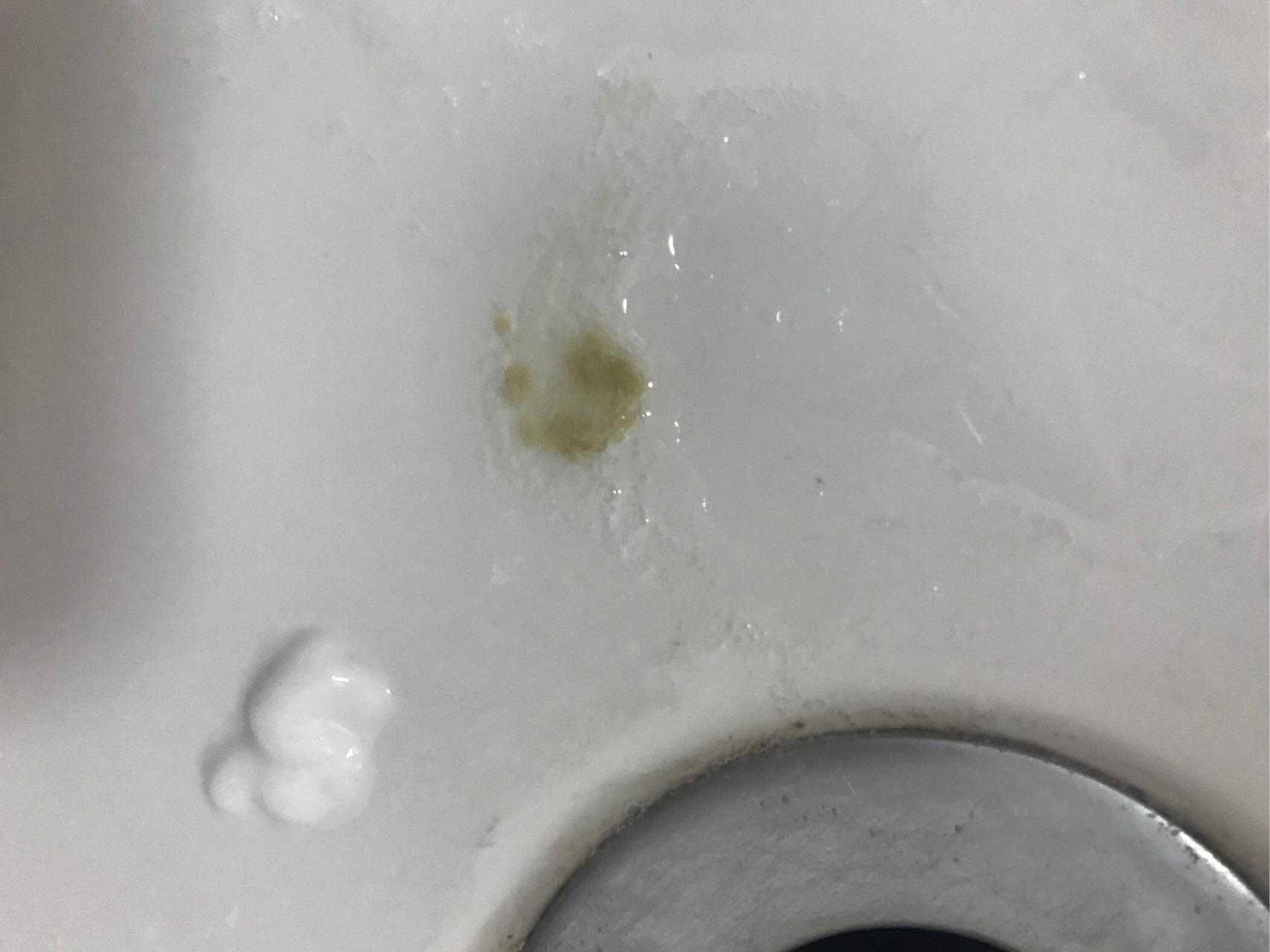 黄痰是什么原因 知乎