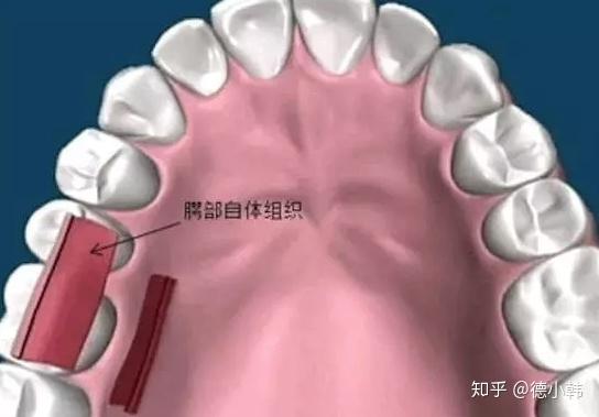 25岁牙龈已经开始萎缩了怎么办太可怕了该注意哪些谢谢