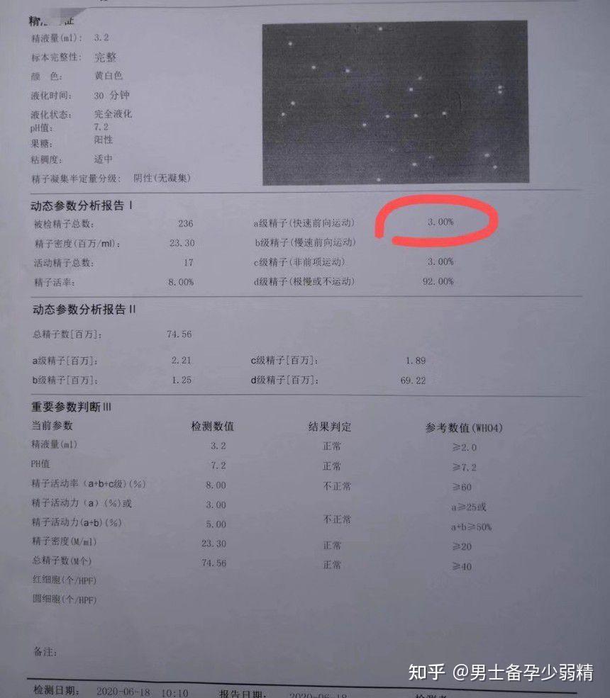 我老公的精子质量不好,我们是准备备孕的,想先帮他调理一下,怎么调理?