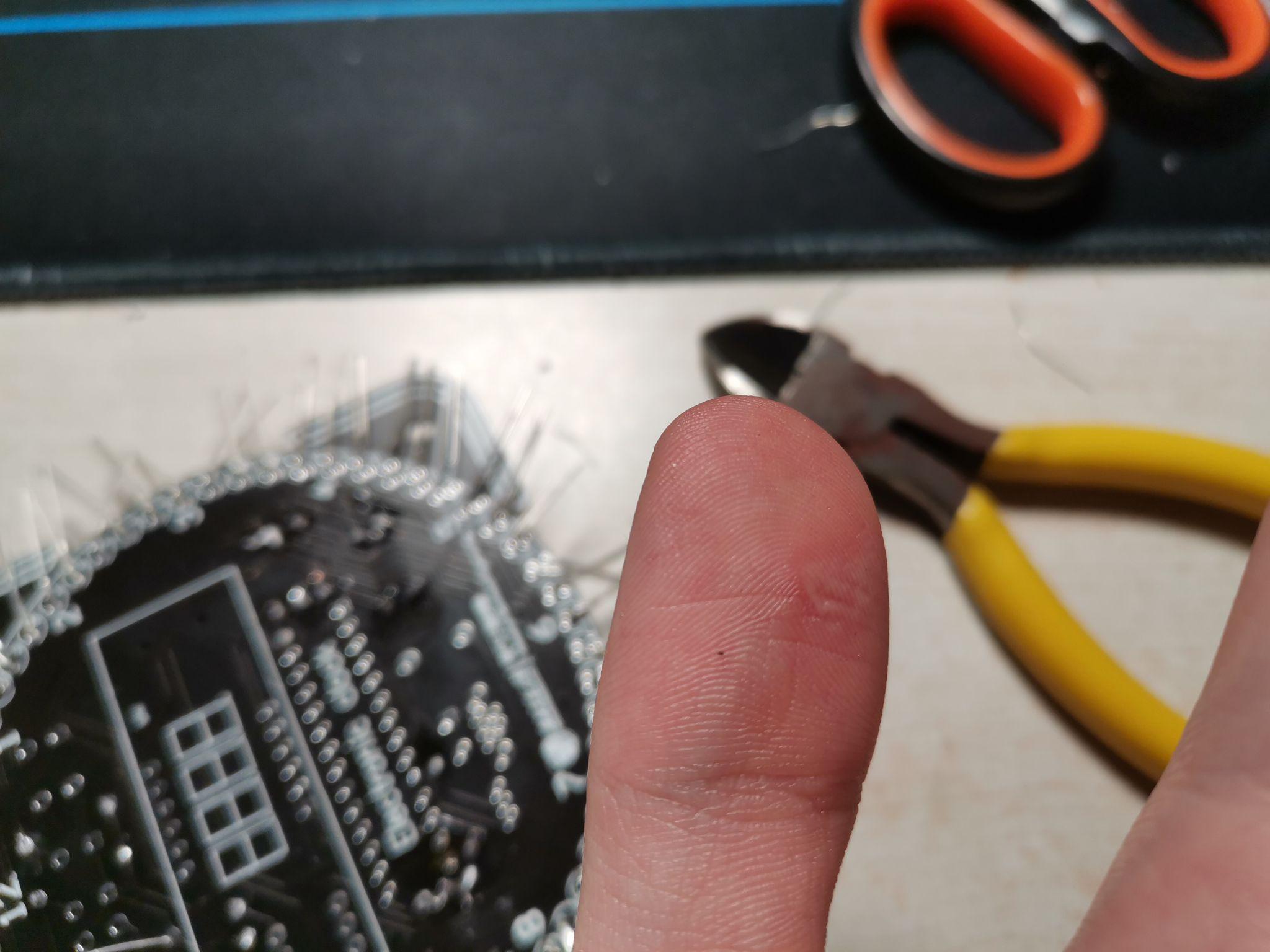 被电烙铁烫伤是一种什么样的体验?怎么处理不易留疤 知乎