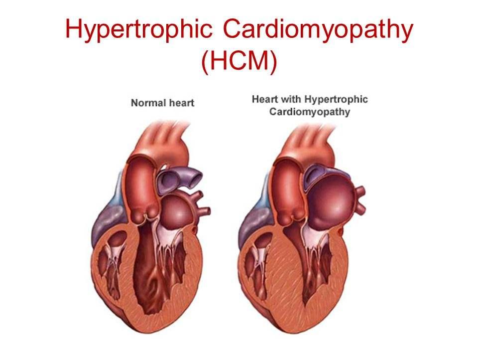 猫心肌肥厚除了知道你还可以做更多