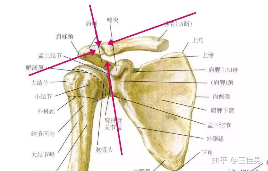 请问懂人体的大佬图中红圈中的凸起是肩峰还是锁骨呢