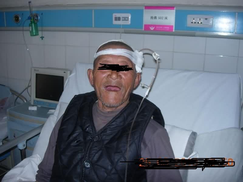 先流出的是血还是脑浆