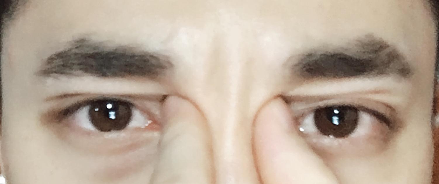男生内双怎样能够变成外双,最好不用贴或者手术? - 知乎