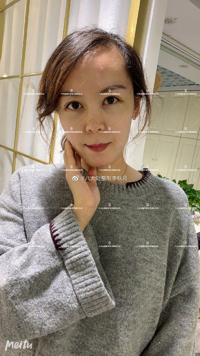 八大处整型医院名医挂号＋票贩子号贩子的简单介绍