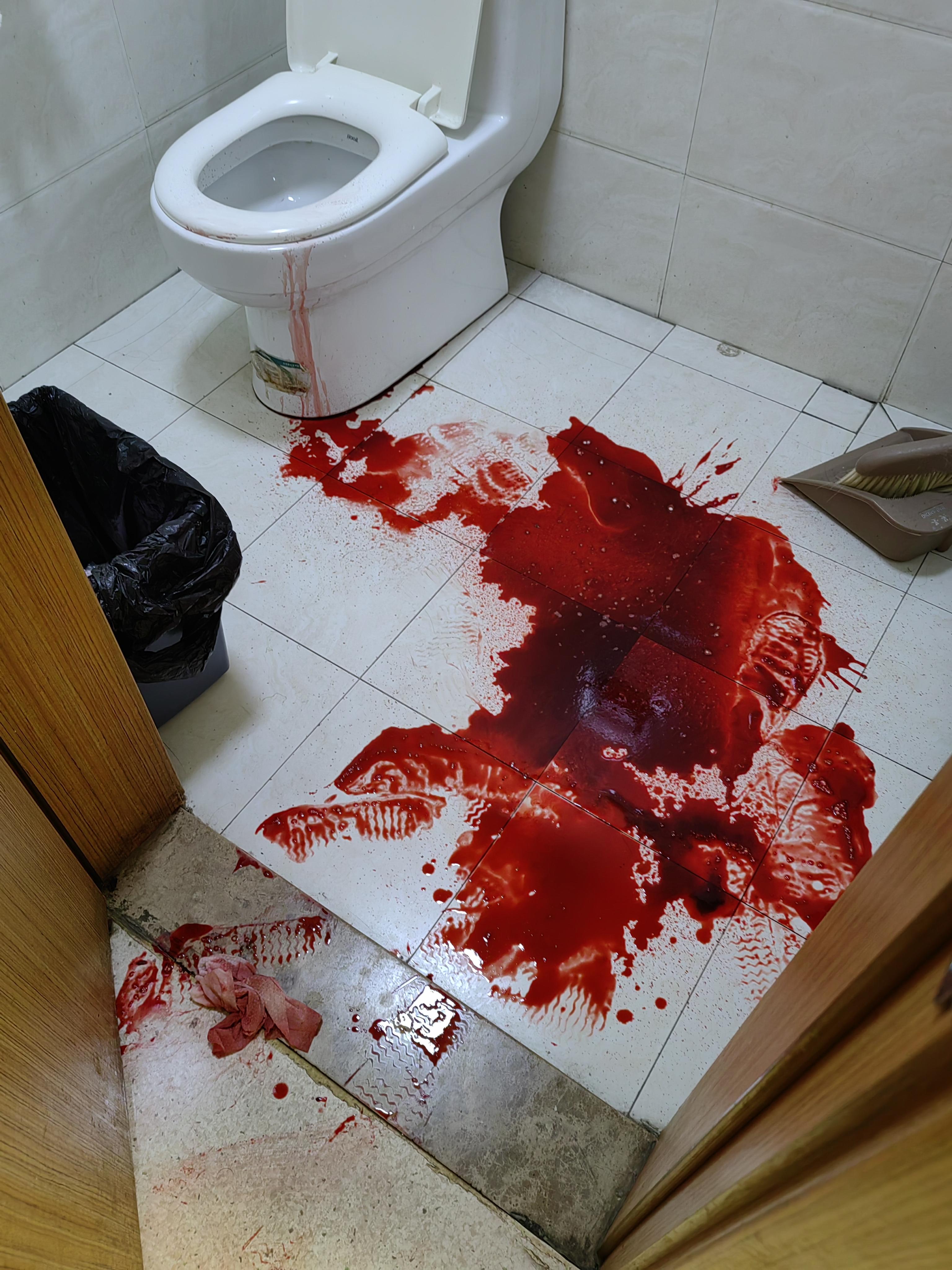 镇静的医生老娘体弱一体多病在医院住院自己上厕所突