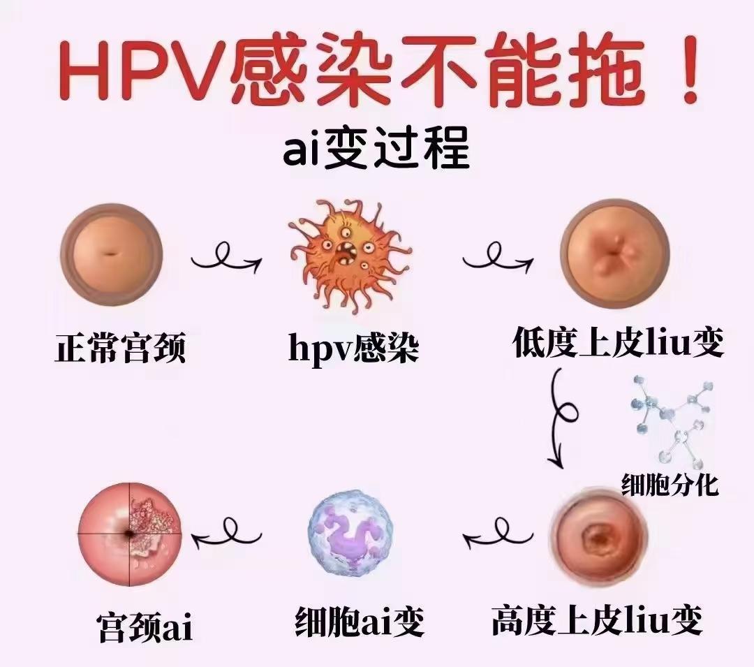 虽然hpv不一定宫颈ai,但hpv感染是宫颈ai的必要条件!