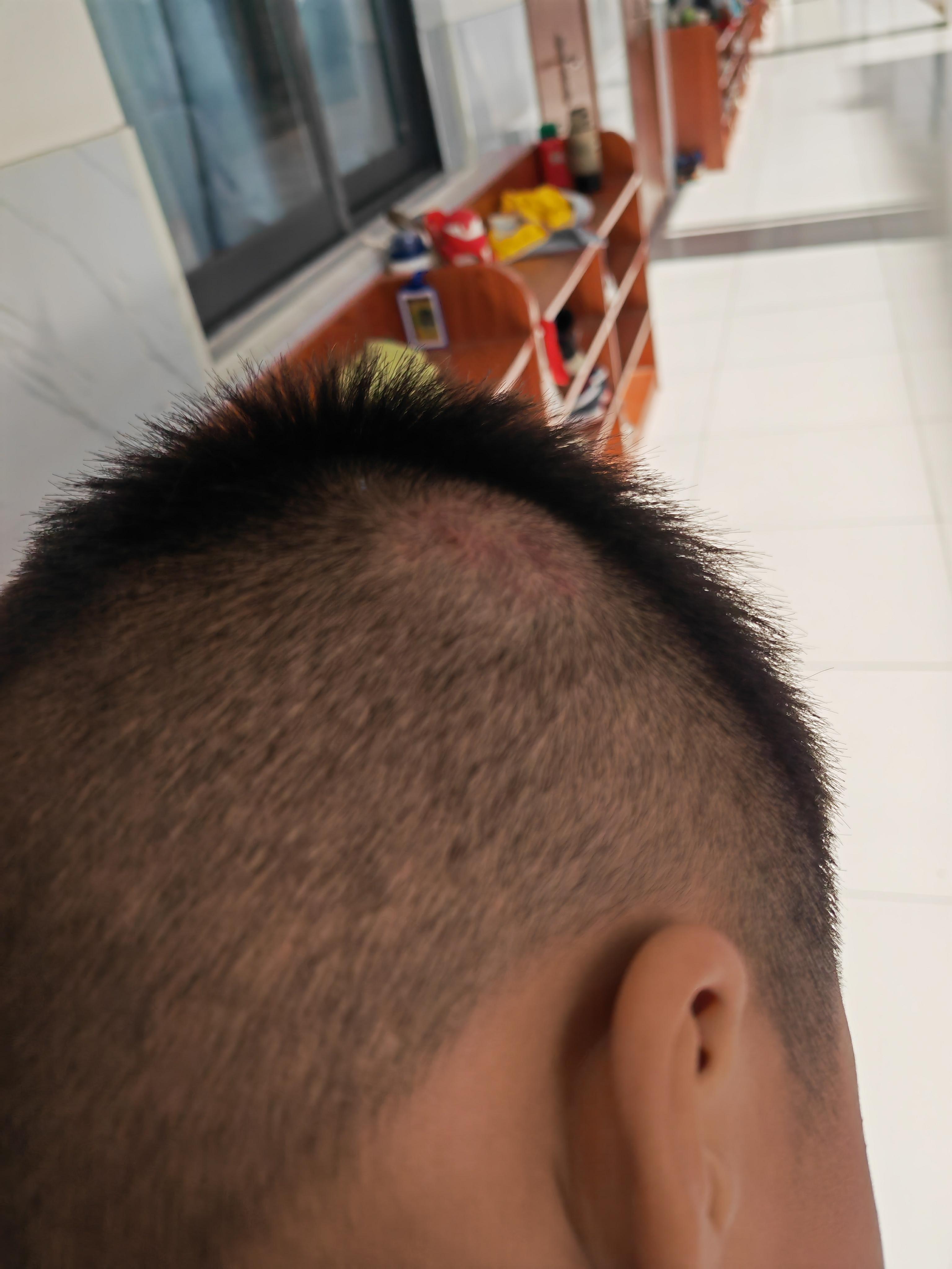 想拥抱的孤岛 的想法: 头上整了个大包