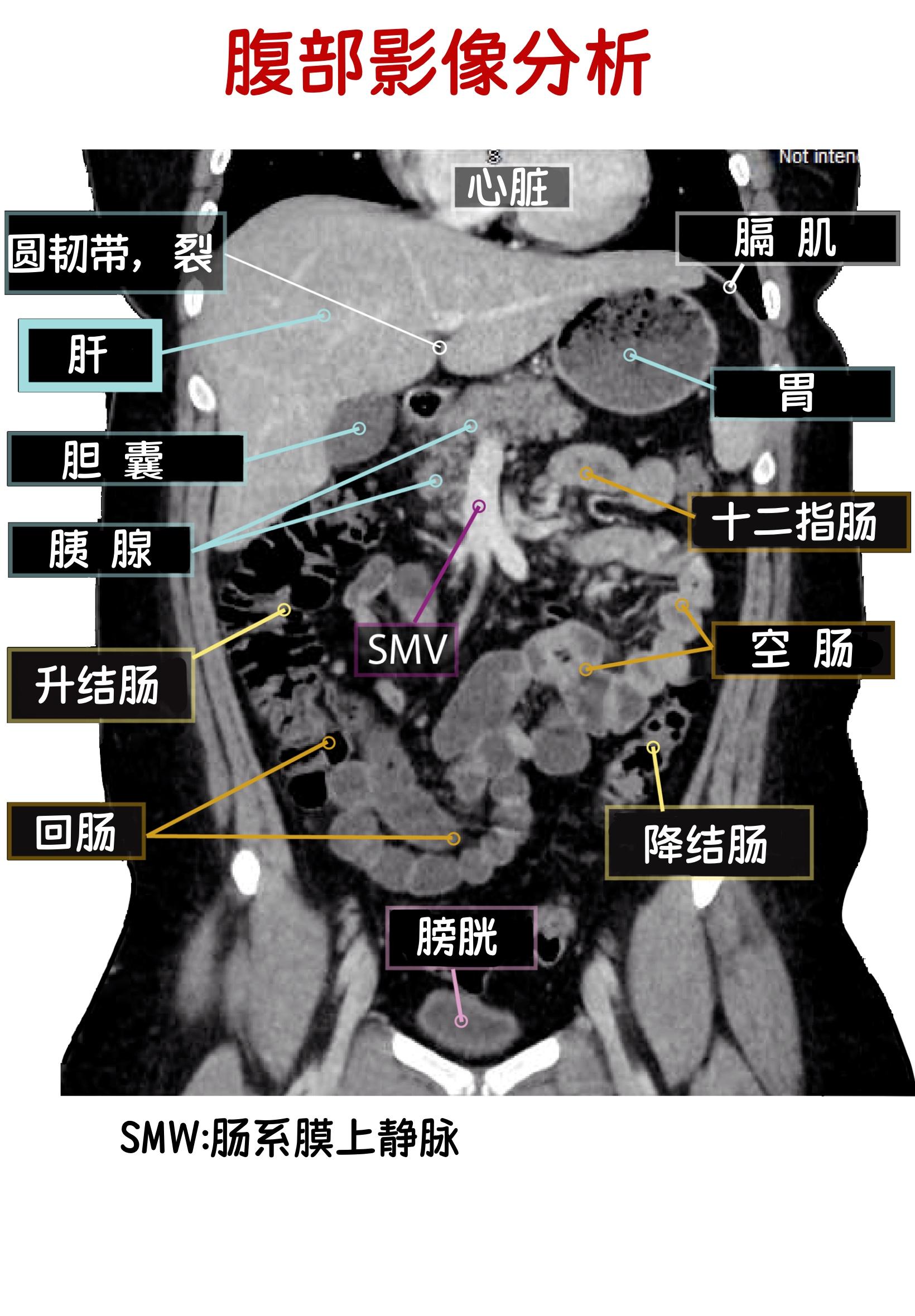 如何看懂腹部彩超图图片