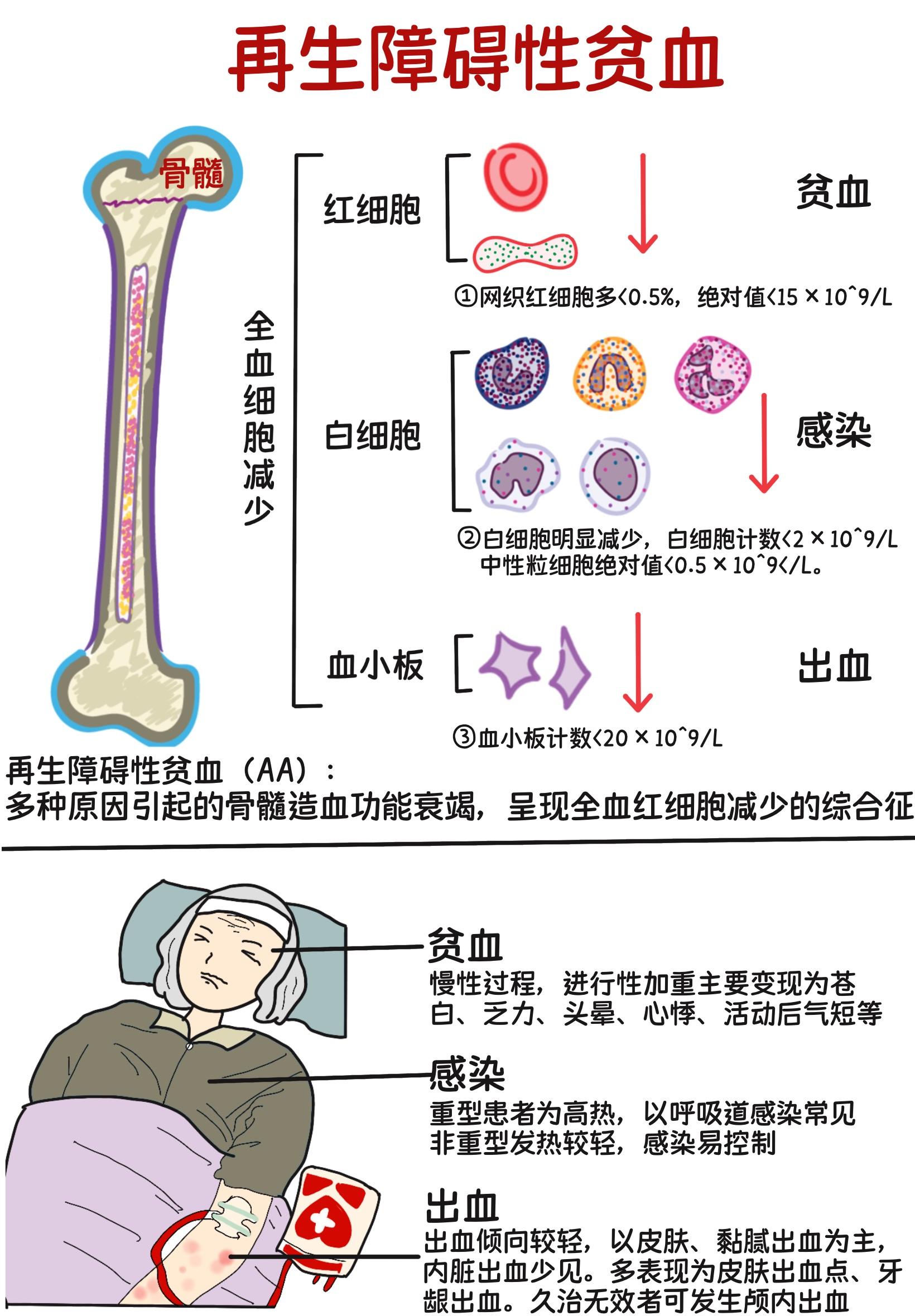 再生障碍性贫血