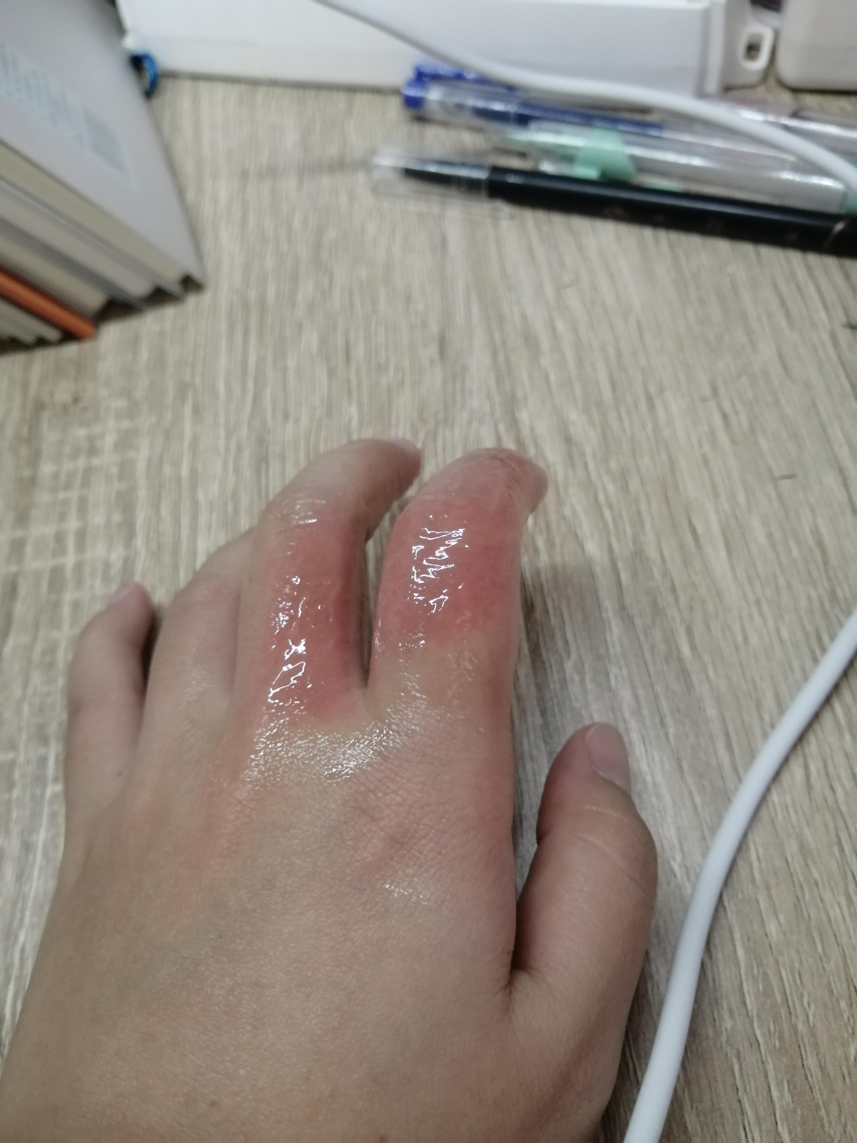 📅用一张照片记录今天: 📸我的拍摄设备: #随拍打卡 手烫伤一般