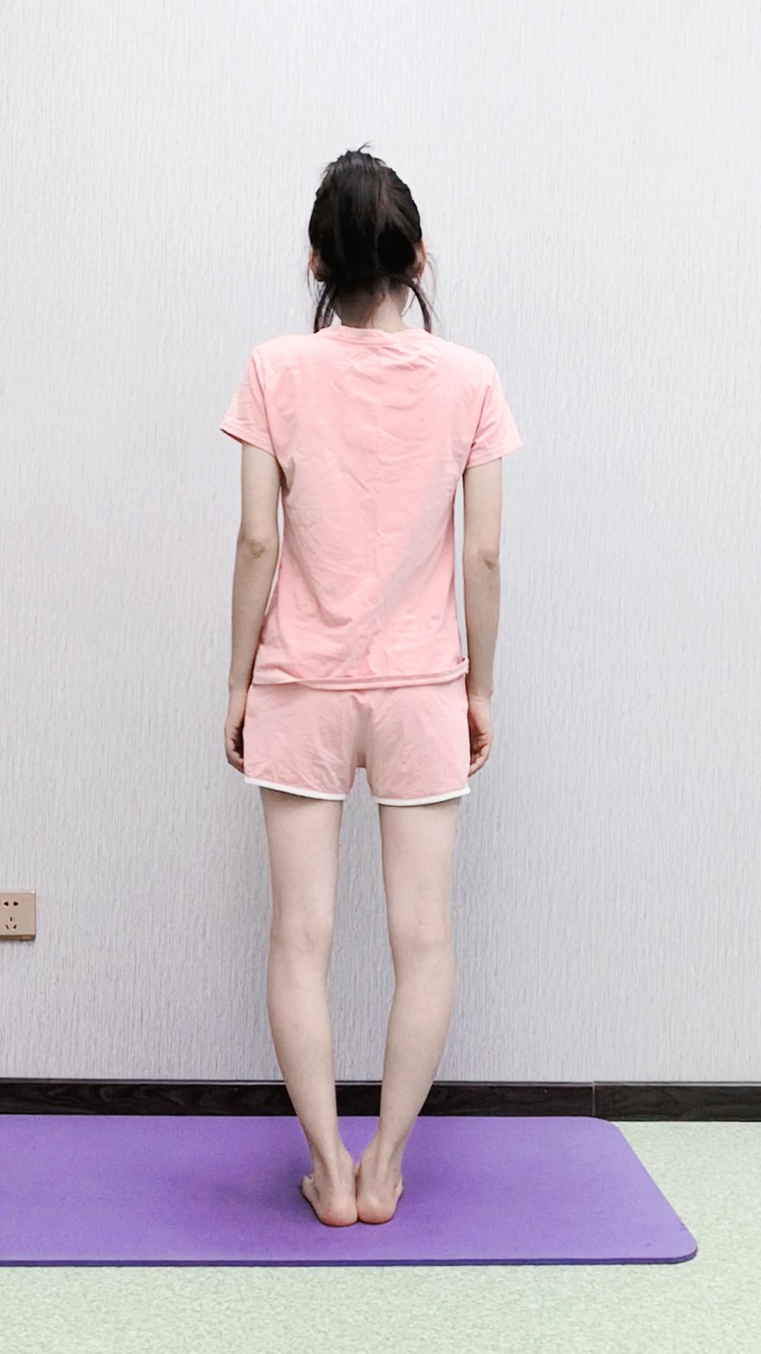 o型腿,医学上称为膝内翻,主要表现为站立时双足并拢而膝关节无法