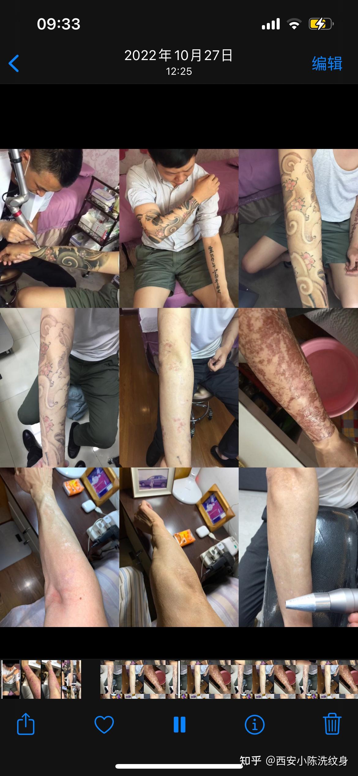 西安小陈洗纹身 - 知乎
