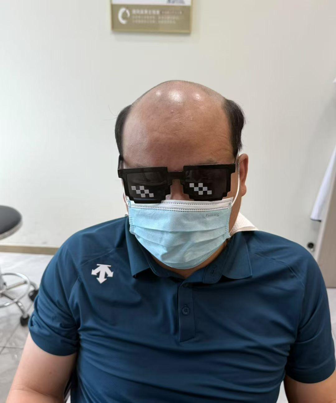 聊聊被脱发偷走的自信,和找回来