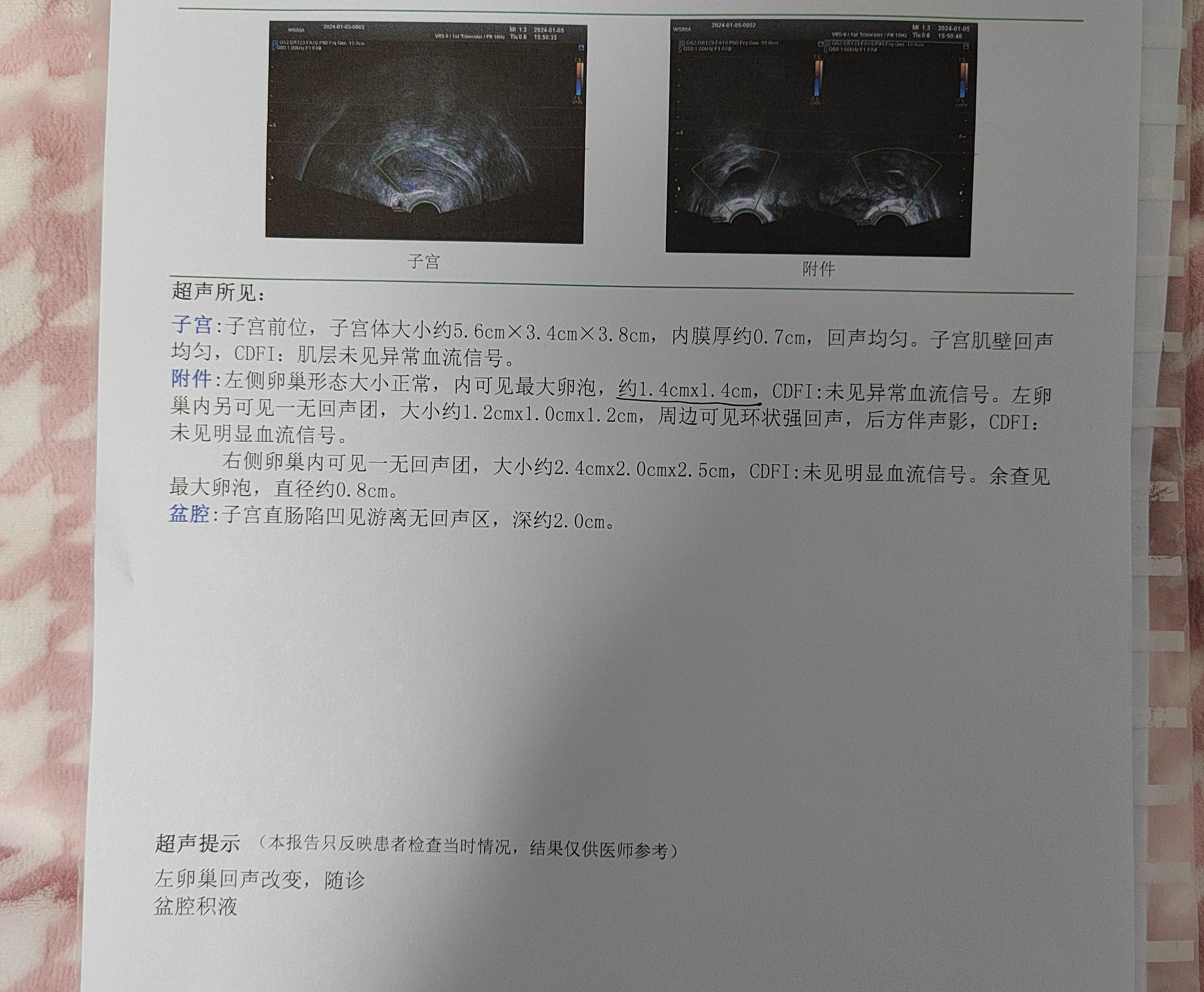 阴超报告阴超图片阴超图子宫阴超正常报告图片阴超检查结果妇科阴超