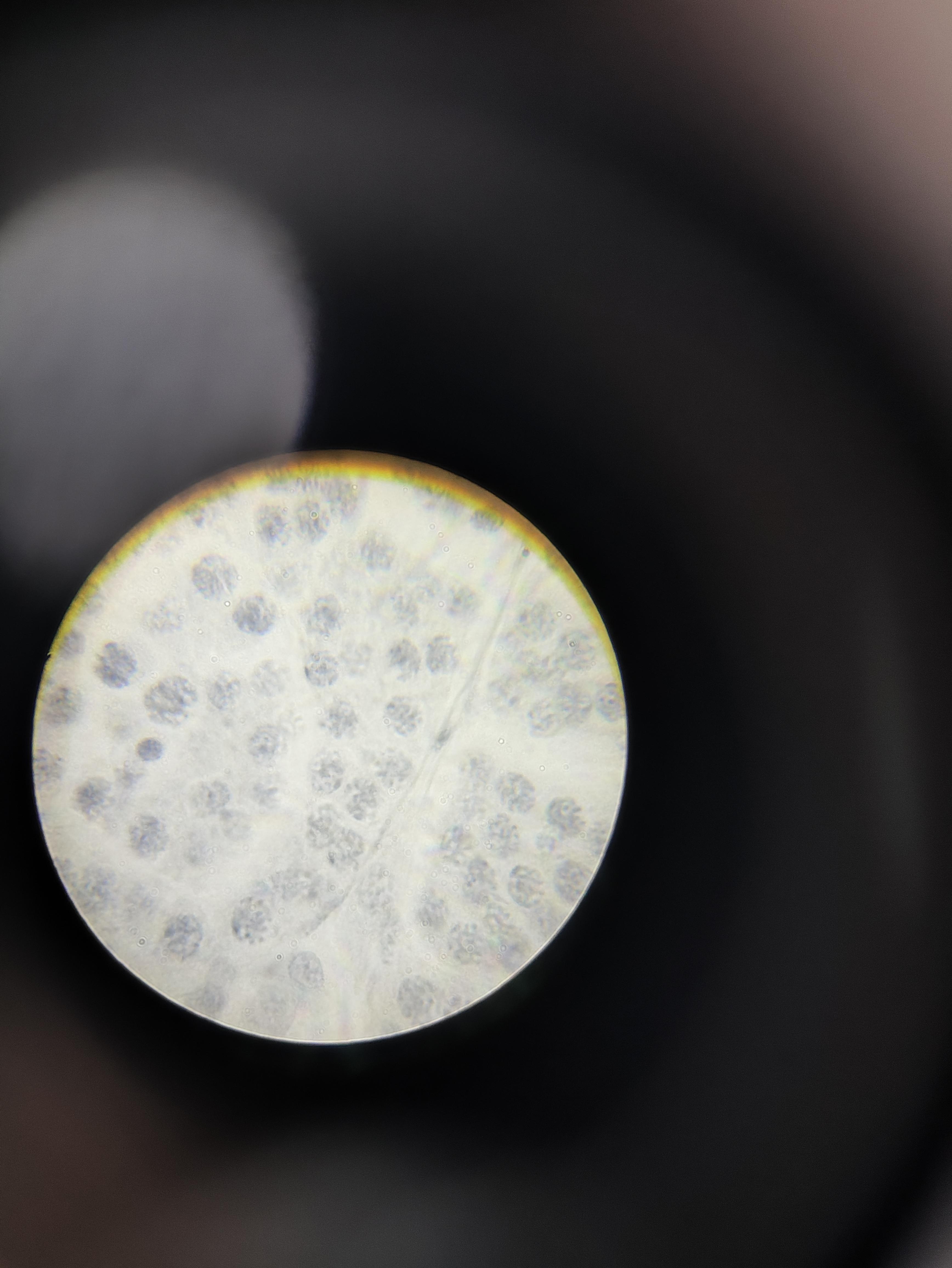 暖葵终北 的想法: 左边是用1000倍光学显微镜看的蝗虫精巢永久装片