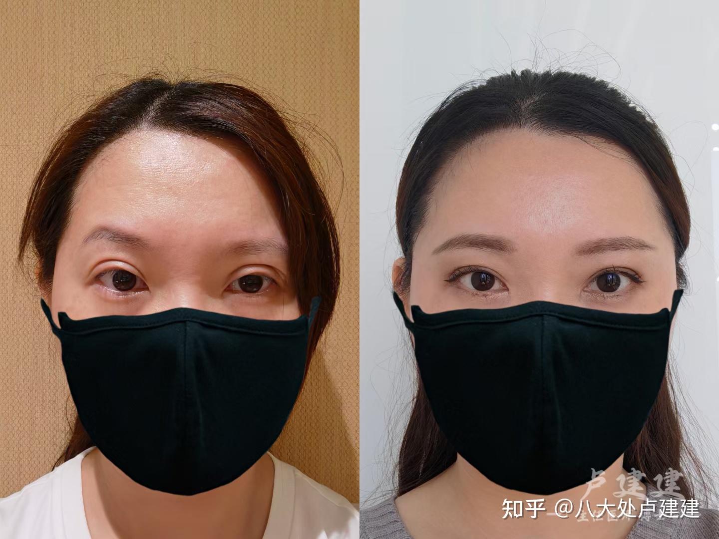 八大处整型医院全科黄牛挂号的简单介绍