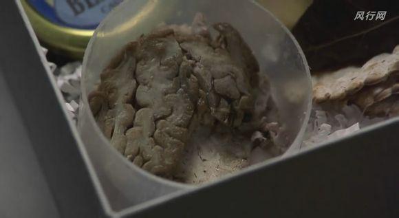 汉尼拔最后小孩吃了人脑揭示了什么