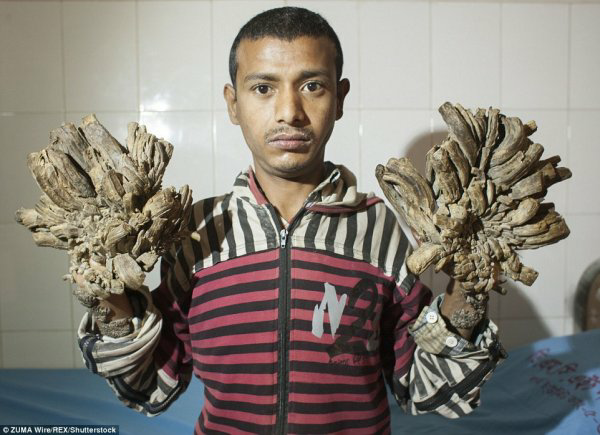 身上长藤壶是一种怎样的体验