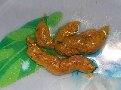 屎是什么味的？