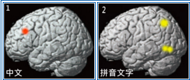 为什么在中国很少听说阅读障碍和失语症？ - 知乎