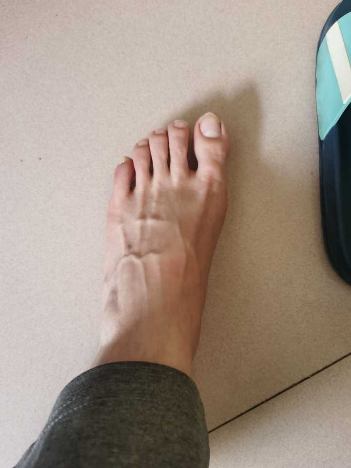 喜欢男人的脚，尤其是穿球鞋还有裸着的脚，我是不是有病？