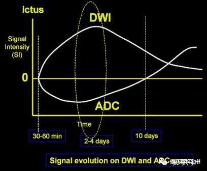 adc 值在医学影像中有何意义？ - 知乎