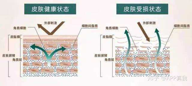 痘印心得经验_痘印心得经验_痘印心得经验