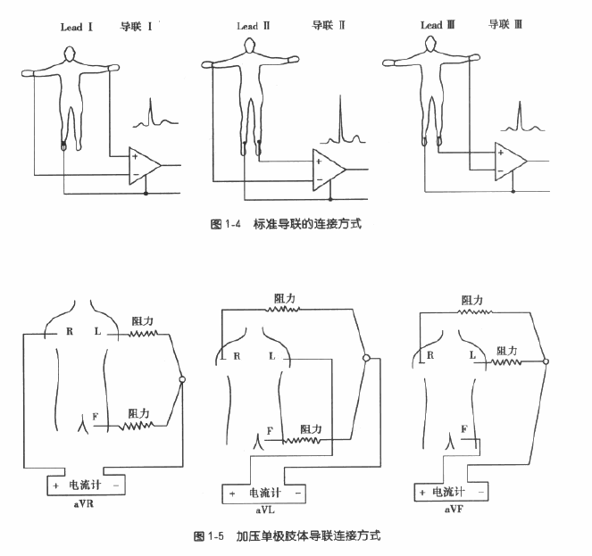 心电图导联？