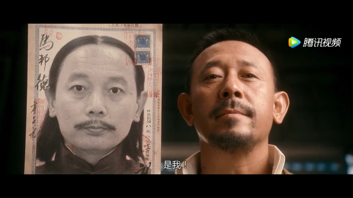 双眼皮的价格_全切双眼皮价格_郑大一附院割双眼皮价格