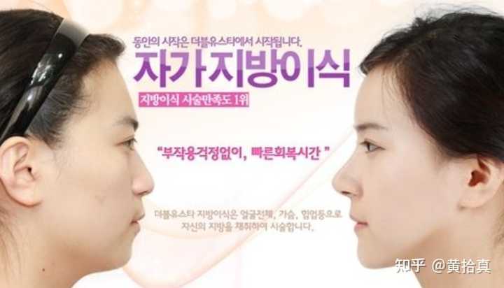 额头难看眉骨高怎么办 知乎